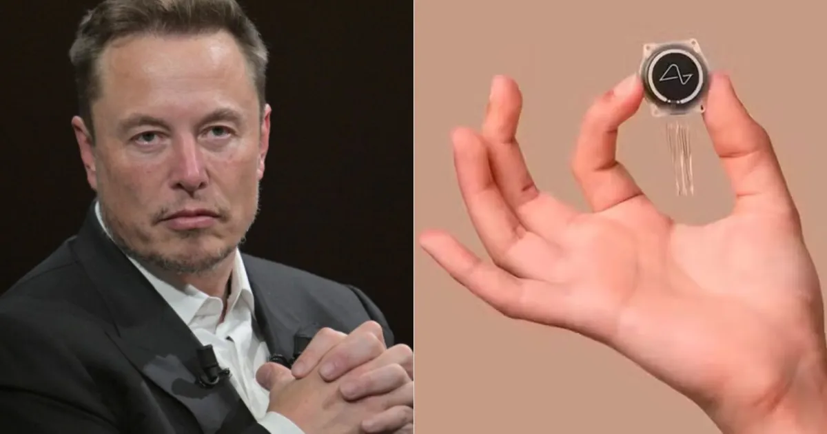 Blindsight: conheça chip cerebral com o qual Musk promete devolver visão a cegos - Rádio Itatiaia