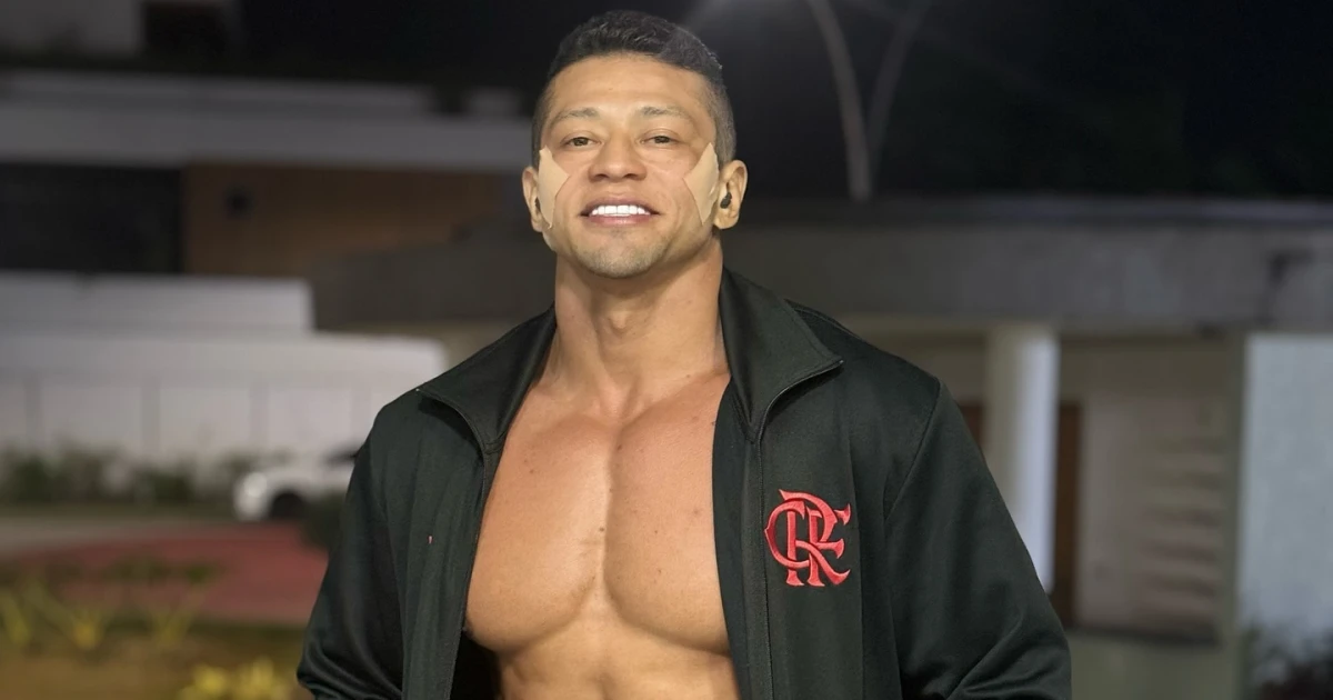 Ex-affair de Gracyanne Barbosa, Gilson, realiza harmonização íntima ...