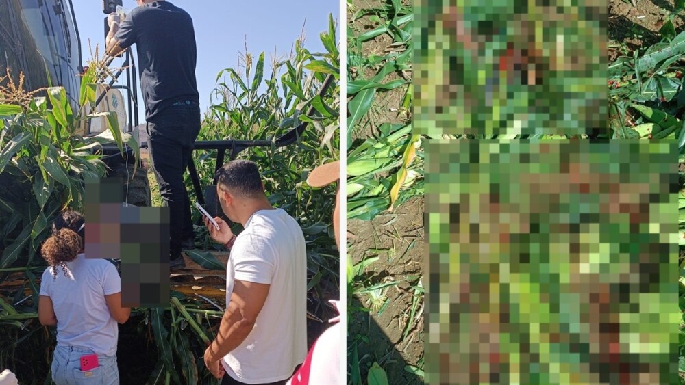 Fotos mostram homem que teve pernas engolidas por máquina de moer milho