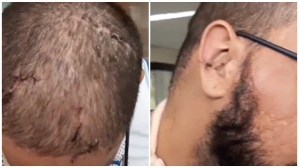Torcedor identificado como Hugo deixou o Hospital João XIII com vários ferimentos na cabeça