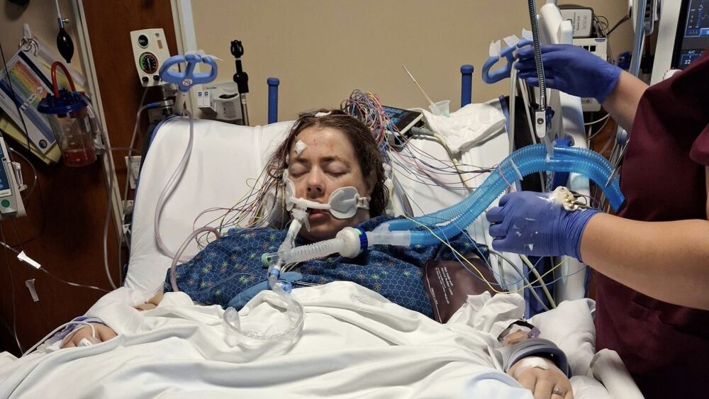 Mulher fica em coma após uso excessivo de 'vape': 'Uma gosma preta saindo do meu nariz e da minha boca' - Rádio Itatiaia