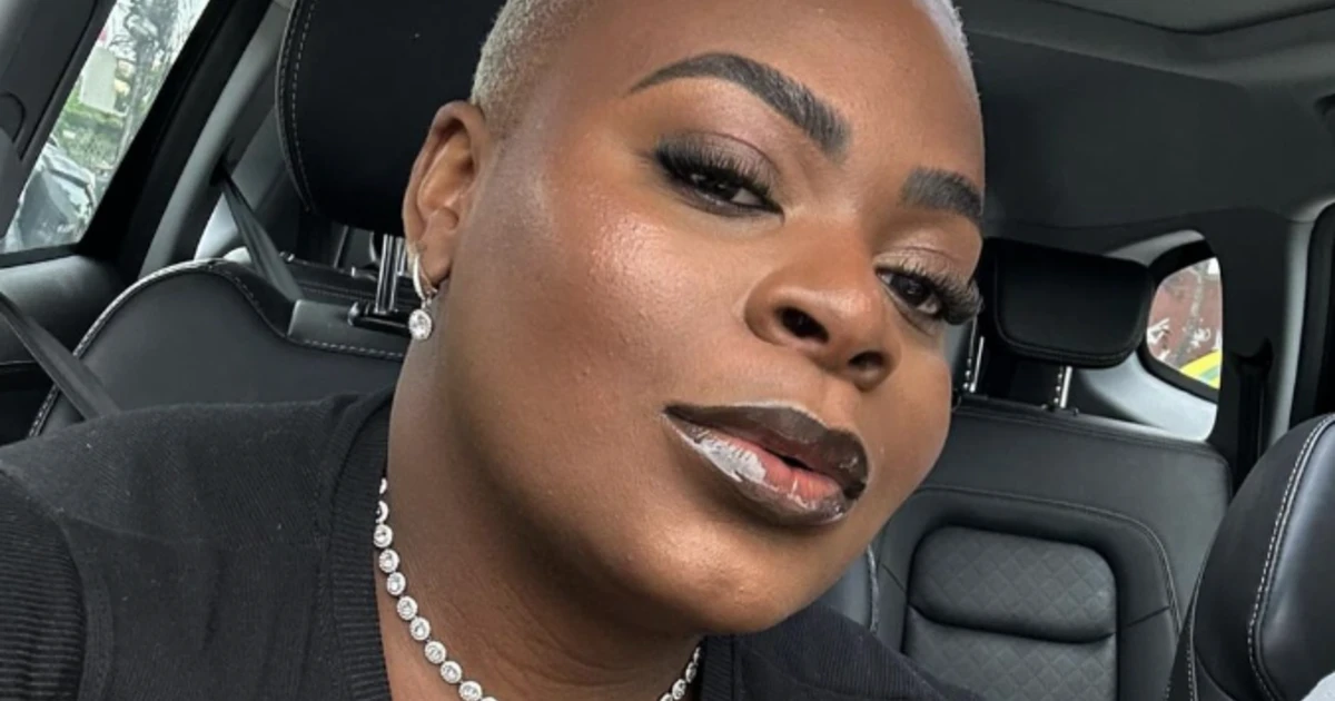 Jojo Todinho makes his first appearance after liposuction and surprises with his “tiny waist” Jojo Todinho makes his first appearance after liposuction and surprises with his “tiny waist”