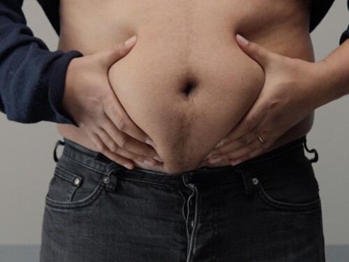 Gordura abdominal e saúde cardíaca: por que a localização importa mais que o peso
