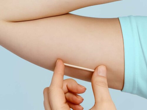 Ouro Preto começa a oferecer Implanon nas unidades de saúde do SUS