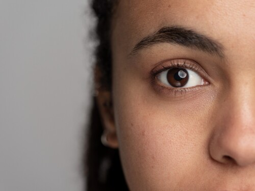 Atenção: esta manchinha no olho pode ser sinal de câncer raro
