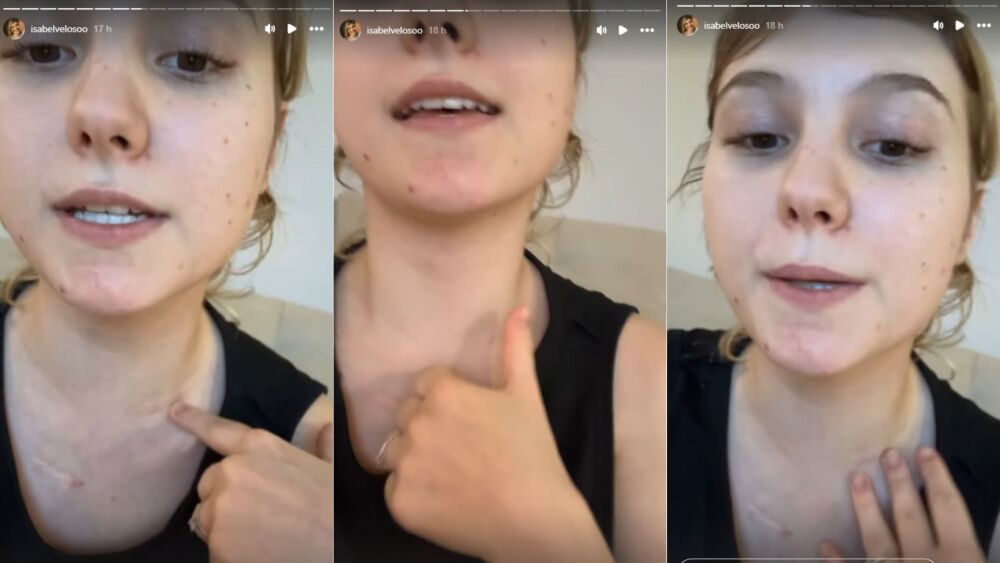 Com câncer terminal, Isabel Veloso desabafa sobre tratamento exaustivo - Rádio Itatiaia