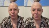 Roseane Sarney foi diagnosticada com câncer em agosto
