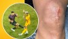 Momento em que Kevin Ramírez é atingido por Alan Kardec em Athletico-PR x Amazonas