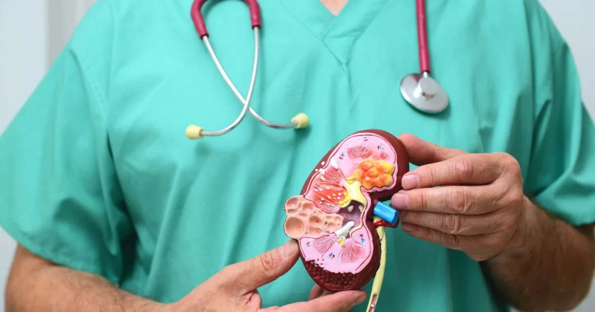 Câncer de Rim: Como o Seu Estilo de Vida Pode Influenciar o Risco e o Que Você Pode Fazer