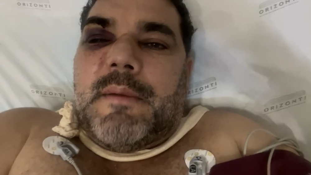 Flamenguista agrdido por atleticanos se recupera de fraturas no rosto, lesão no olho e traumatismo craniano no CTI